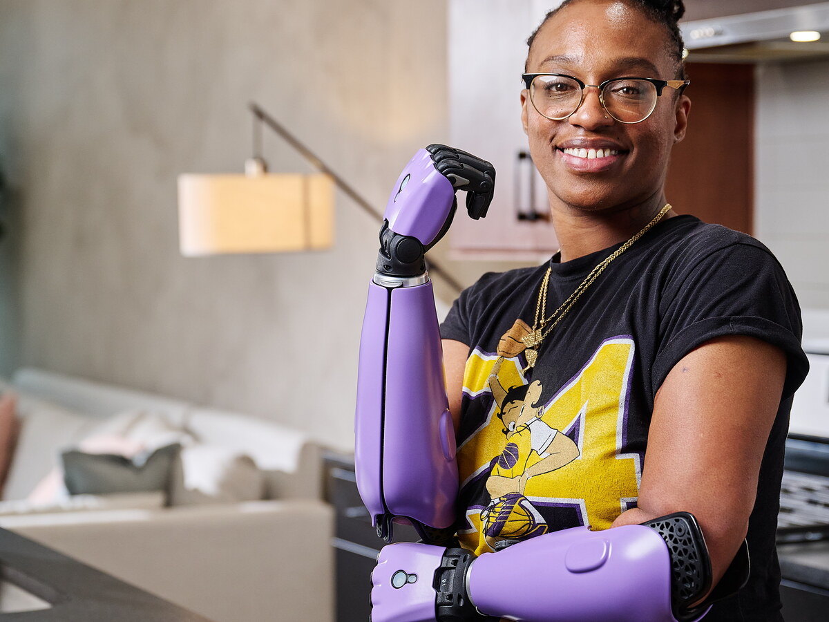 Woman with a purple Hero PRO bionic arm at home in the kitchen