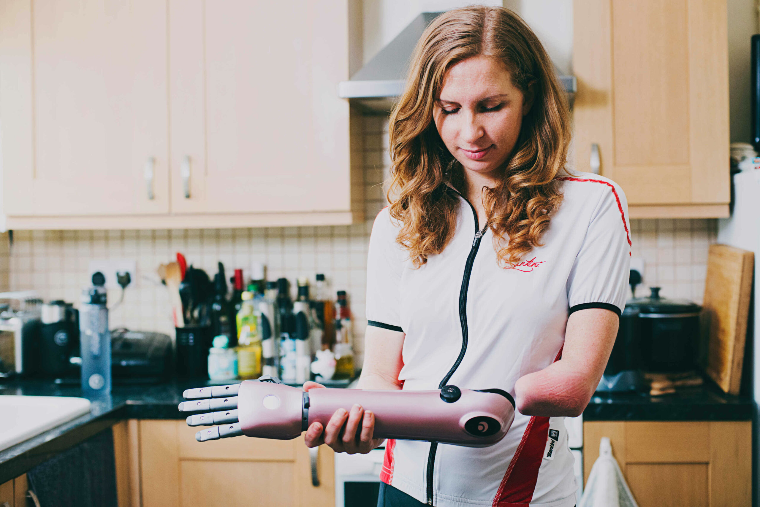 how does a bionic arm work - Open Bionics