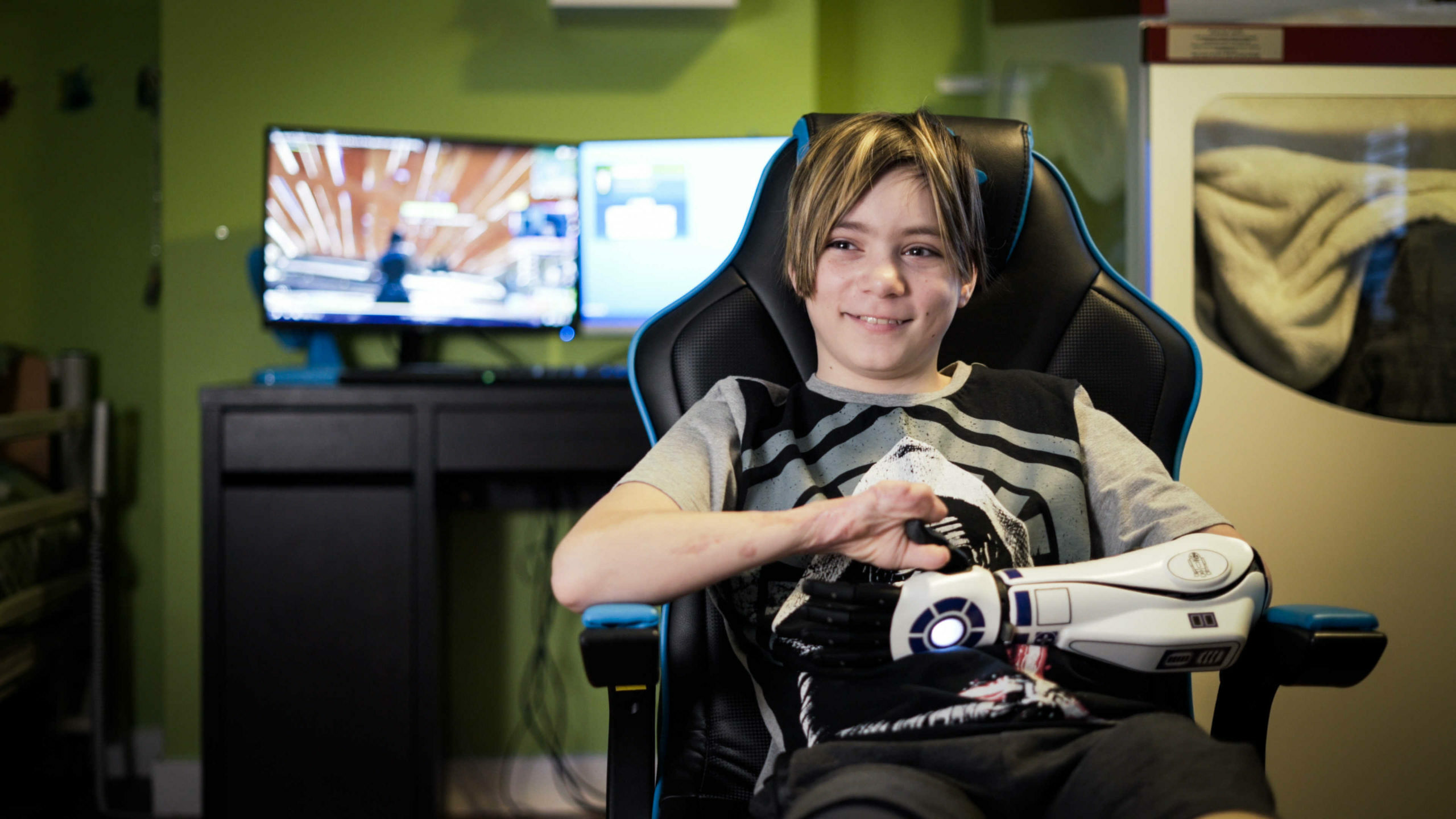 first child in the world to wear Star Wars 3d printed prosthetic arm