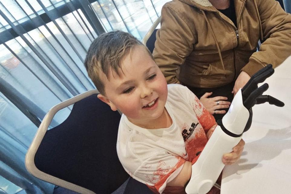 UK Boy Gifted £13,000 for Bionic Hero Arm