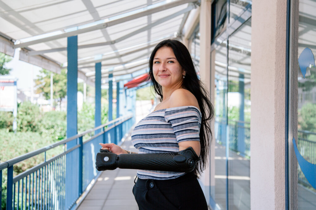 World’s First 3D Printed Bionic Arm is Now Available to Amputees Across Germany 🇩🇪