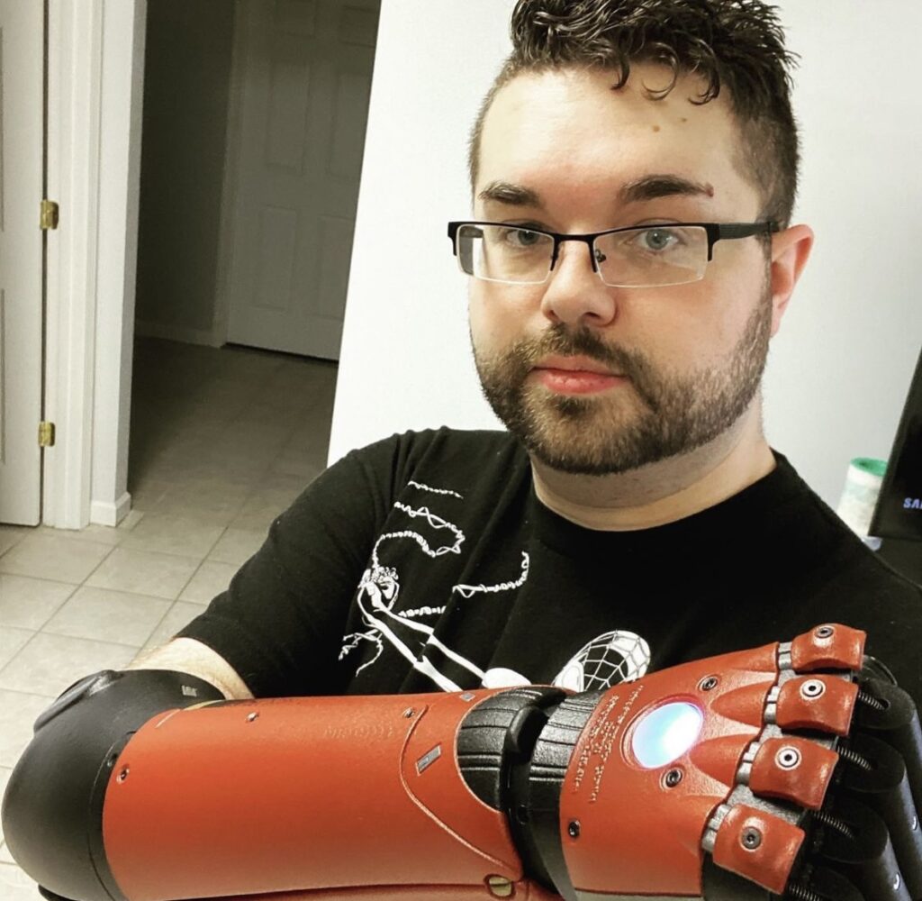 3 Years On: Q&A with Hero Arm User Travis Amburgey