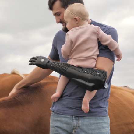 The Hero Arm is a Prosthetic Arm Made by Open Bionics