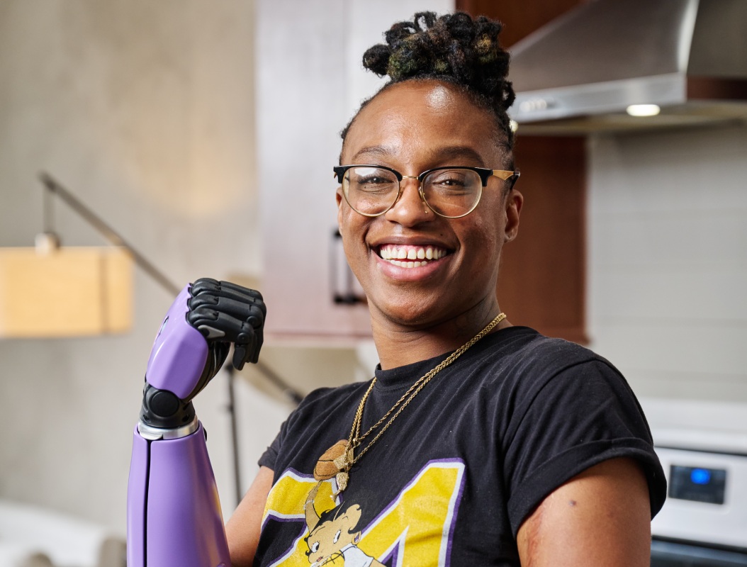 woman with bionic arm