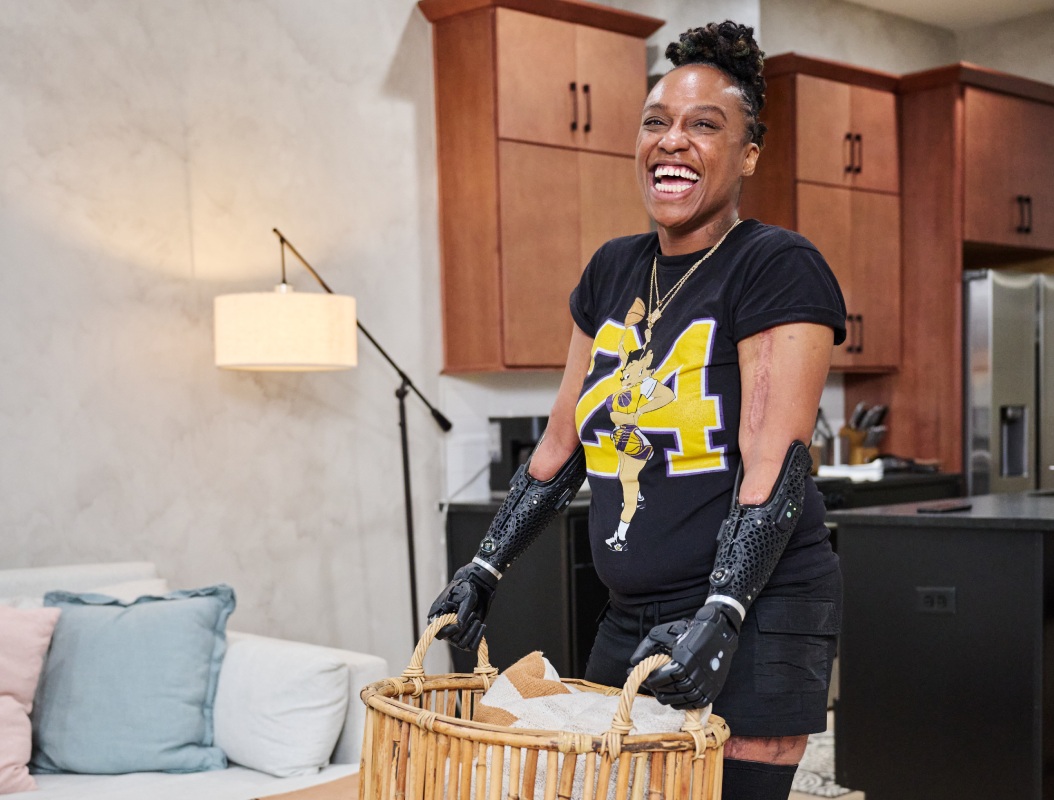 women with bionic arm with washing basket