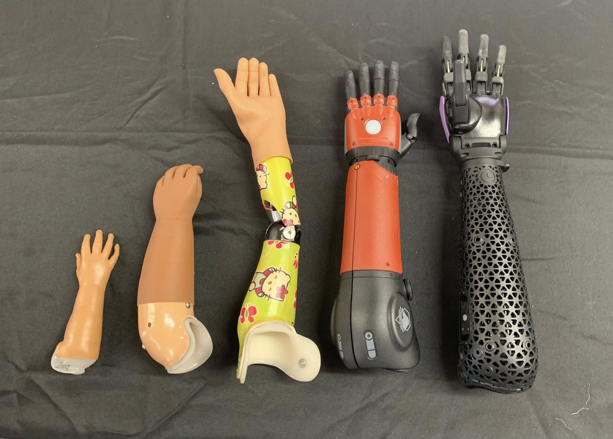 Types of Prosthetic Arms